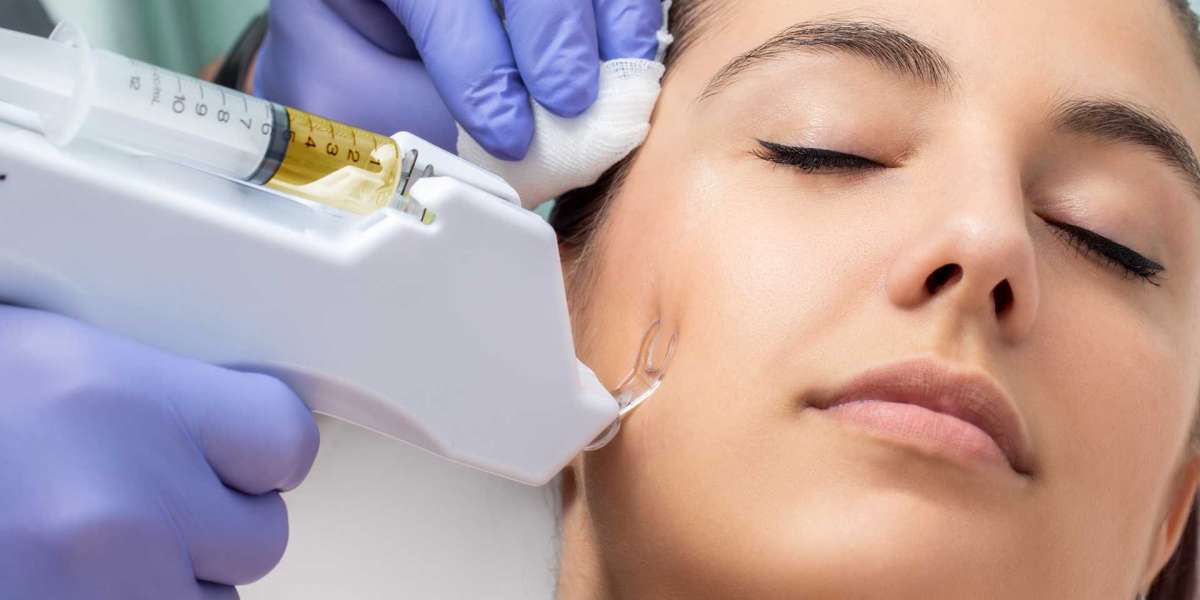 How to Find Affordable Mesotherapy Options in Dubai?