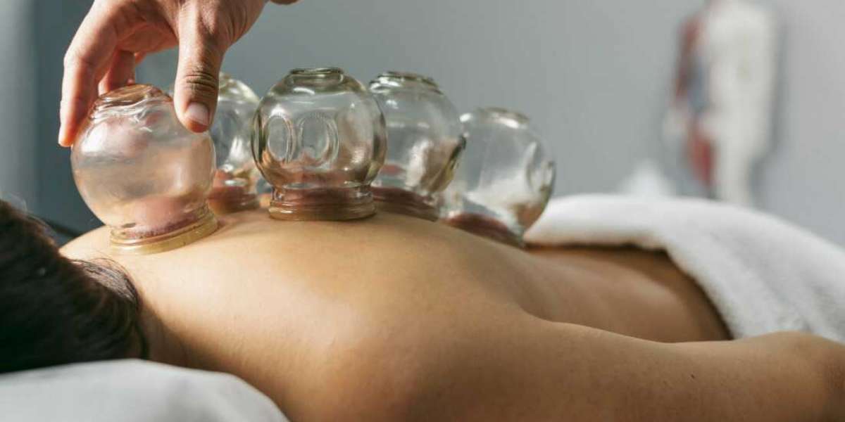 Rejuvenate with Tradition The Rise of Hijama Cupping Therapy in Dubai