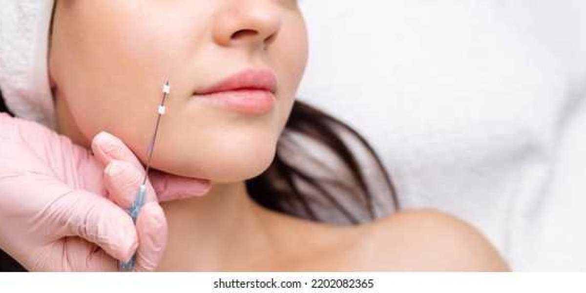 Thread Lift Dubai: Say Goodbye to Sagging Skin